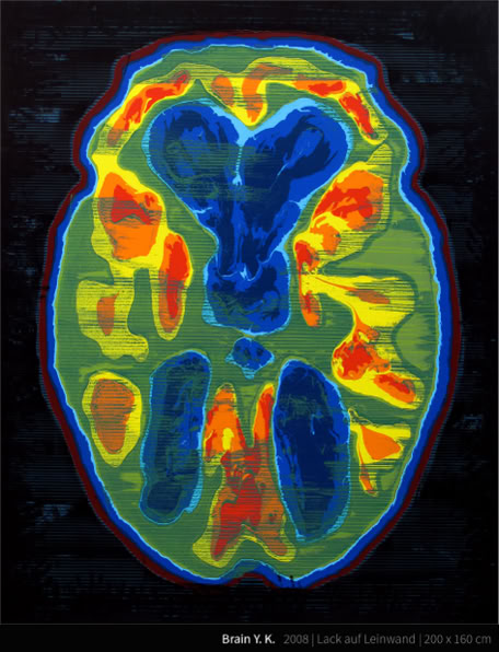 Brain Y. K. - Yves Klein (korrekte Aussprache: [iv klɛ̃], * 28. April 1928 in Nizza; † 6. Juni 1962 in Paris) war ein französischer Maler, Bildhauer und Performancekünstler. Er war Mitbegründer und führender Vertreter der Nouveau Réalisme genannten Kunstströmung in Frankreich. Ab 1957 entwickelte Klein die Anthropometrien mit Modellen, die nackt und mit blauer Farbe getränkt die Leinwand mit ihrem Körper bemalten. Hierzu fand als erstes größeres Ereignis 1960 in der Galerie Internationale d’Art Contemporain in Paris die Performance Anthropometrie der Blauen Epoche statt. Dazu spielte ein Orchester ein von Klein komponiertes Stück, die Monotone Symphonie, die nur aus einem einzigen Klang bestand.
