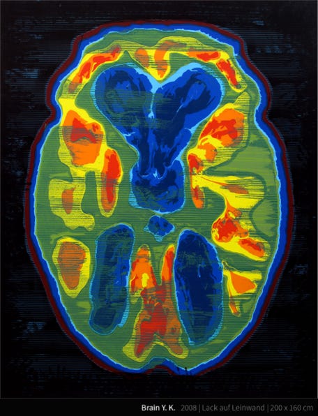 Brain Y. K. - Yves Klein (korrekte Aussprache: [iv klɛ̃], * 28. April 1928 in Nizza; † 6. Juni 1962 in Paris) war ein französischer Maler, Bildhauer und Performancekünstler. Er war Mitbegründer und führender Vertreter der Nouveau Réalisme genannten Kunstströmung in Frankreich. Ab 1957 entwickelte Klein die Anthropometrien mit Modellen, die nackt und mit blauer Farbe getränkt die Leinwand mit ihrem Körper bemalten. Hierzu fand als erstes größeres Ereignis 1960 in der Galerie Internationale d’Art Contemporain in Paris die Performance Anthropometrie der Blauen Epoche statt. Dazu spielte ein Orchester ein von Klein komponiertes Stück, die Monotone Symphonie, die nur aus einem einzigen Klang bestand.